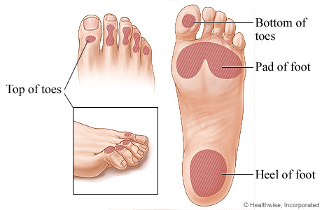 Image result for pressure point on foot for endocrine